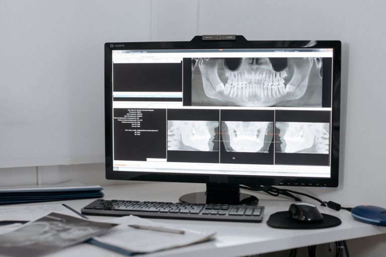 dental-xray-768x512b