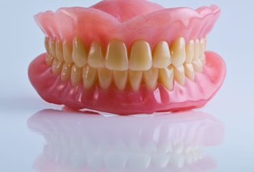 Complete Dentures