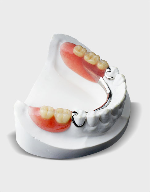 service_thumb_removal_partial_dentures